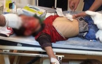 Bir Berkin vakası daha… Yine çocuk