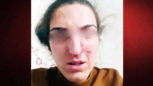 Adalet nedir?